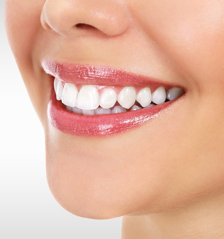 take-home-teeth-whitening-in-pocosmiles-dental